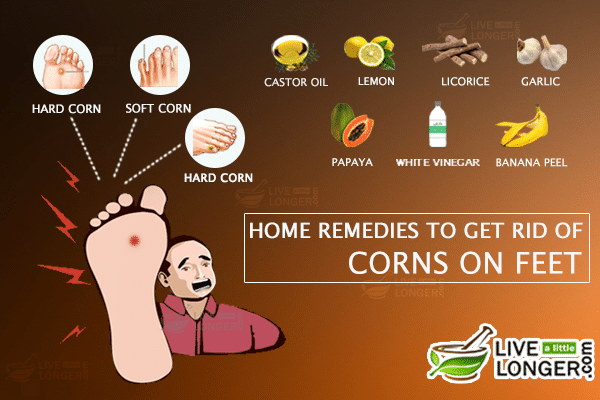 Calluses On Hands And Feet: Simple Home Remedies To Get Rid Of Ugly Corns