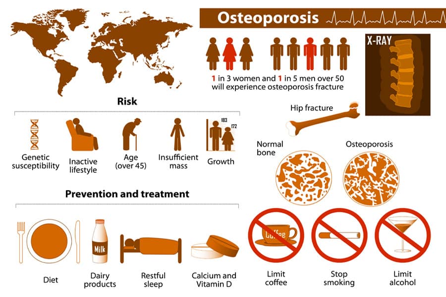best natural treatment for severe osteoporosis